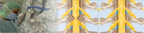 spinalkanalstenose